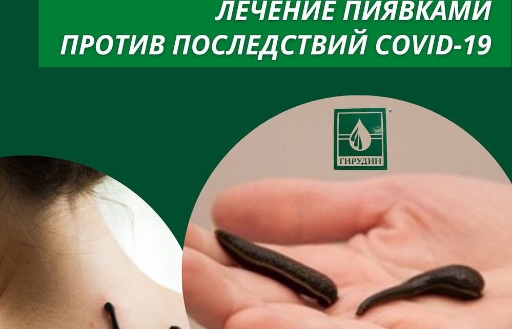 Ученые предлагают лечить последствия COVID с помощью пиявок из Балаково